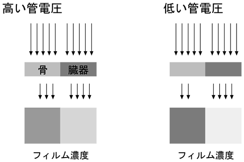 図11 管電圧とフィルム濃度