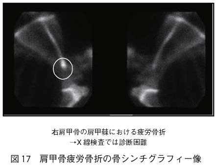 }PV bJ܂̍V`OtB[